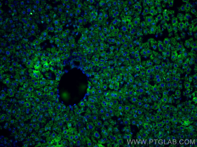 BDH1 Antibody in Immunohistochemistry (Paraffin) (IHC (P))