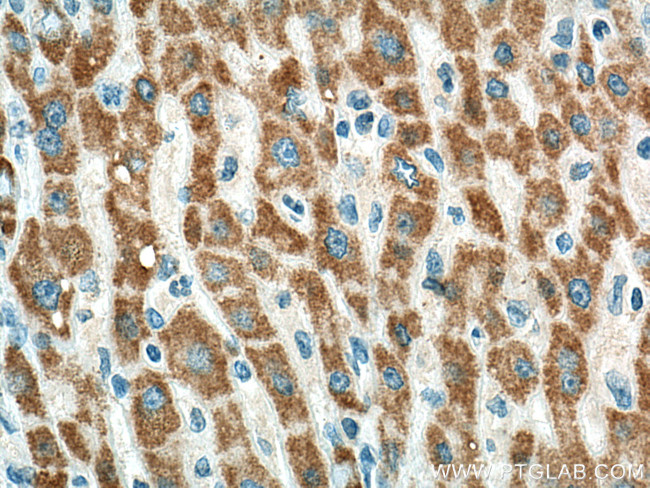 BDH1 Antibody in Immunohistochemistry (Paraffin) (IHC (P))