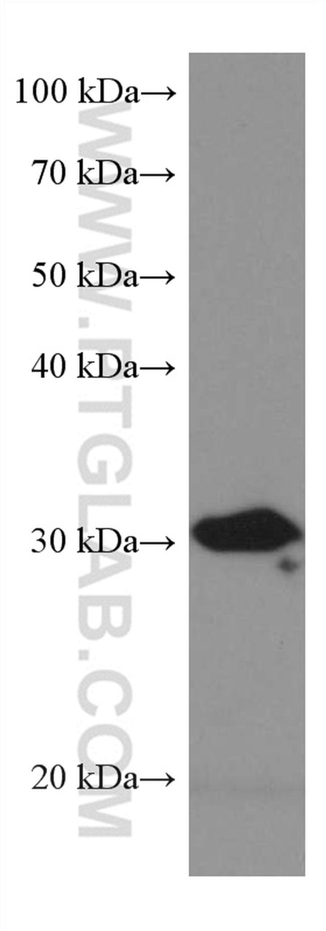 BDH1 Antibody in Western Blot (WB)