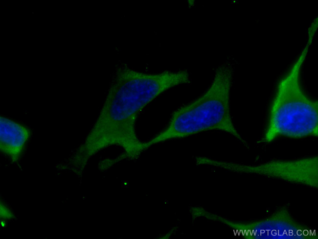 ALDOA Antibody in Immunocytochemistry (ICC/IF)