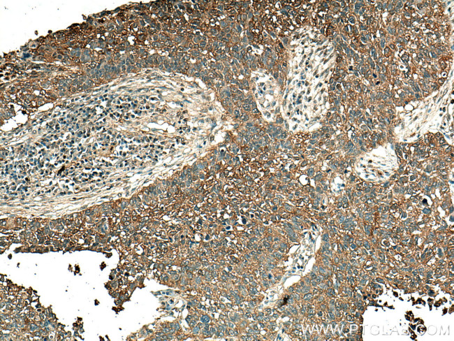 ALDOA Antibody in Immunohistochemistry (Paraffin) (IHC (P))