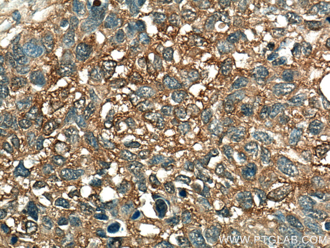 ALDOA Antibody in Immunohistochemistry (Paraffin) (IHC (P))