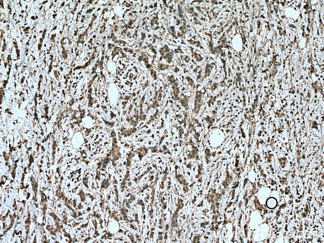 HMBS Antibody in Immunohistochemistry (Paraffin) (IHC (P))