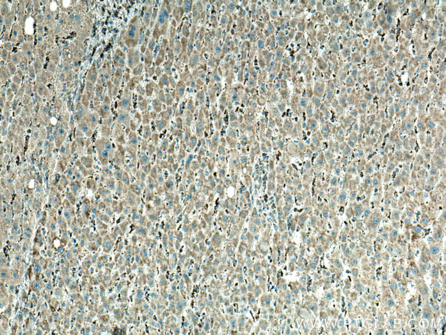 ME2 Antibody in Immunohistochemistry (Paraffin) (IHC (P))