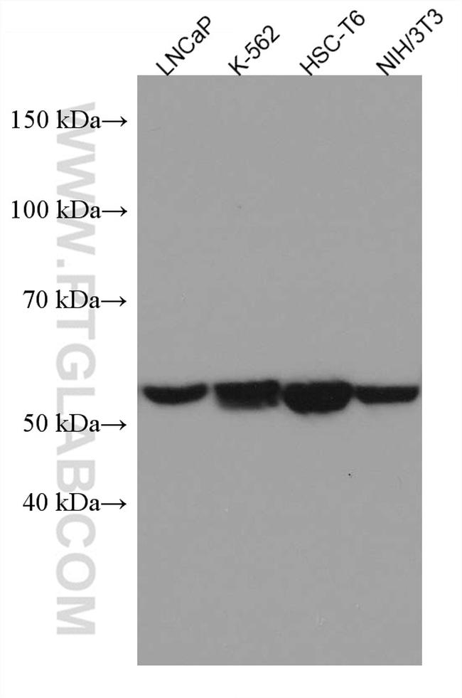 ME2 Antibody in Western Blot (WB)