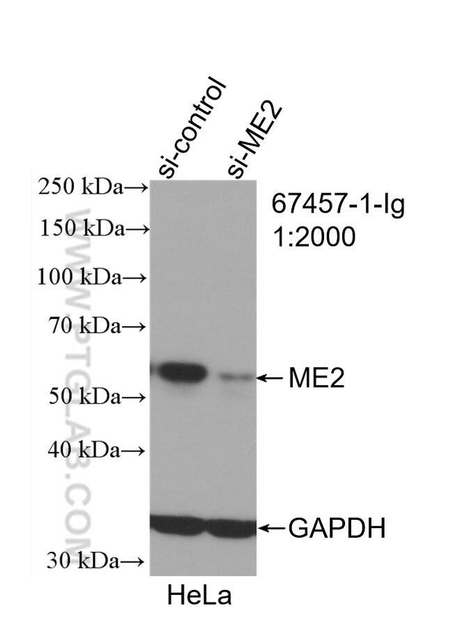 ME2 Antibody in Western Blot (WB)