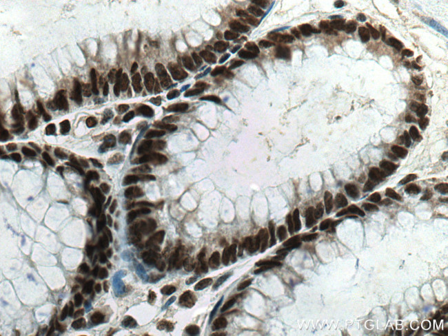 PTBP1 Antibody in Immunohistochemistry (Paraffin) (IHC (P))