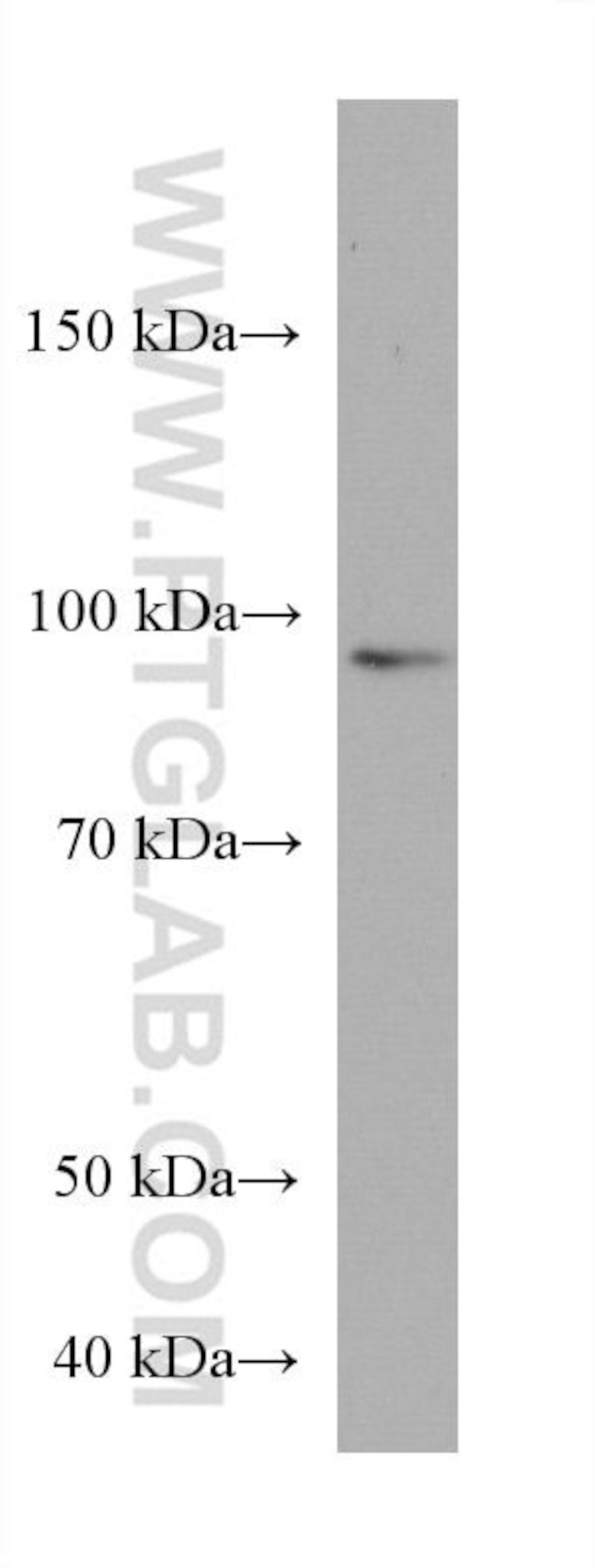 ZNF746 Antibody in Western Blot (WB)