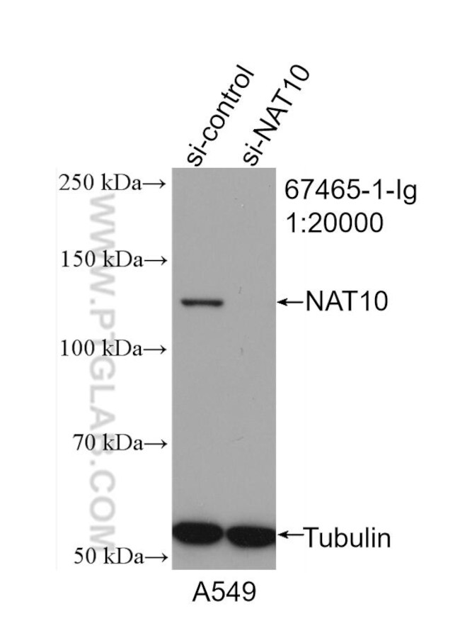 NAT10 Antibody in Western Blot (WB)