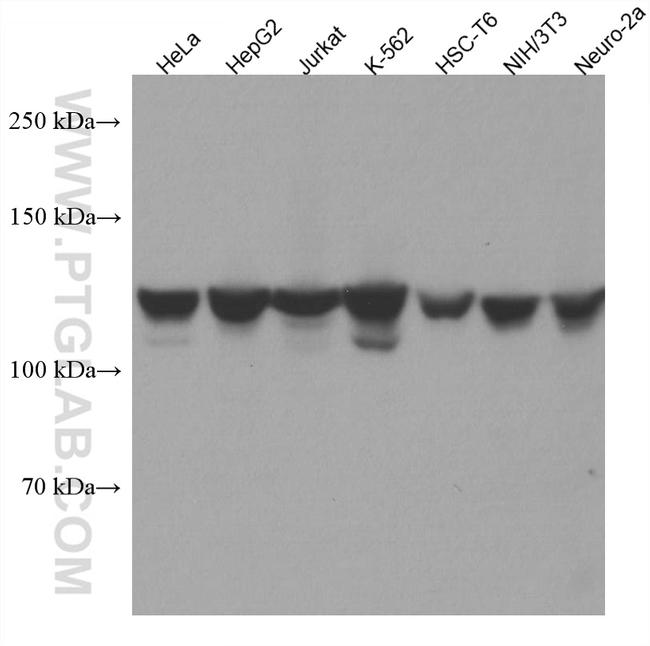 NAT10 Antibody in Western Blot (WB)