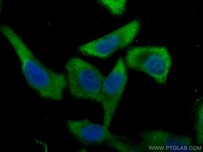 PGAM1 Antibody in Immunocytochemistry (ICC/IF)