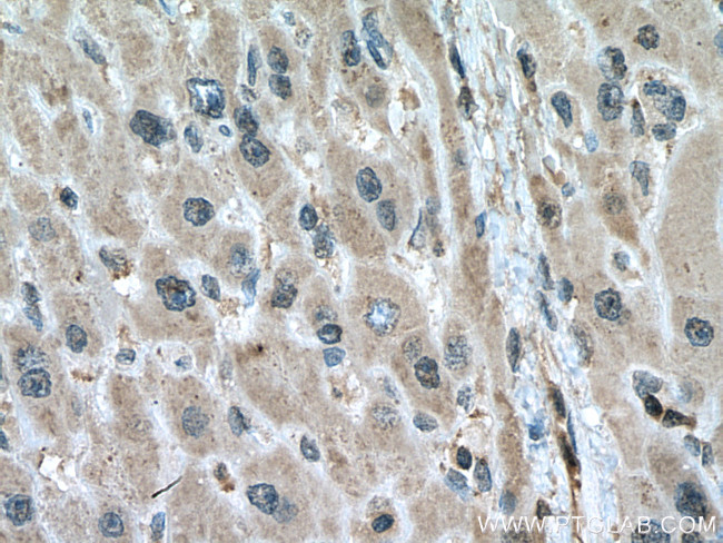 PGAM1 Antibody in Immunohistochemistry (Paraffin) (IHC (P))