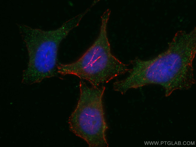 PLCL2 Antibody in Immunocytochemistry (ICC/IF)