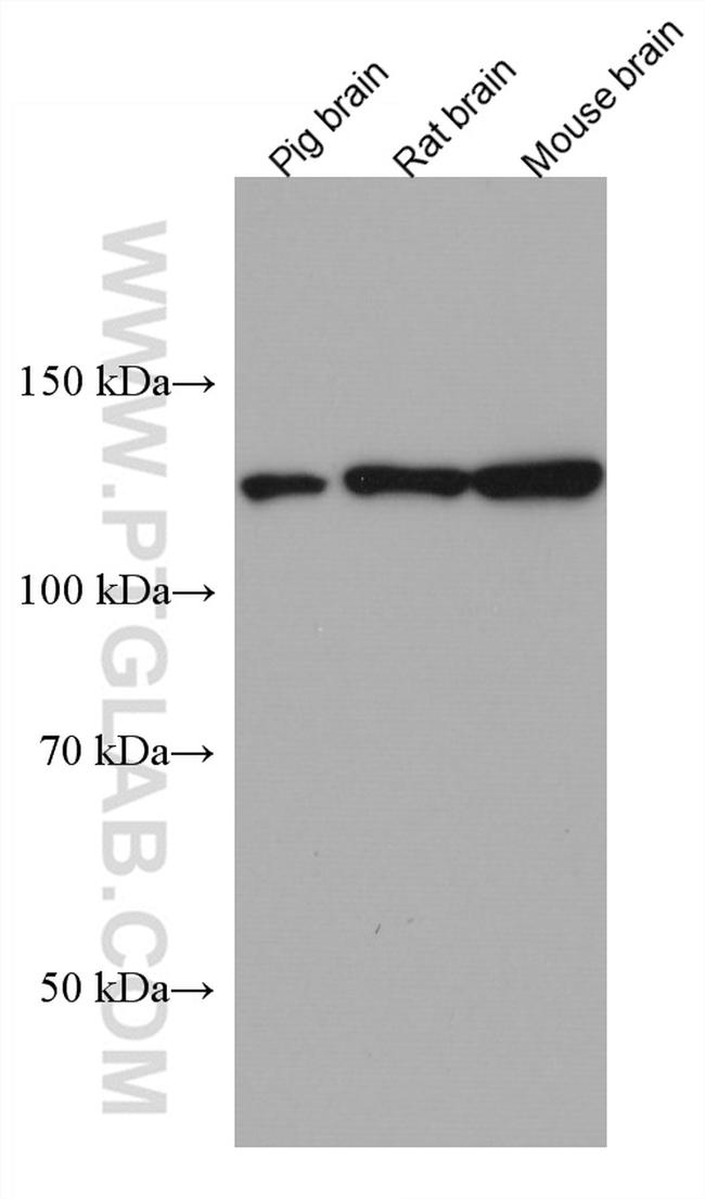 PLCL2 Antibody in Western Blot (WB)