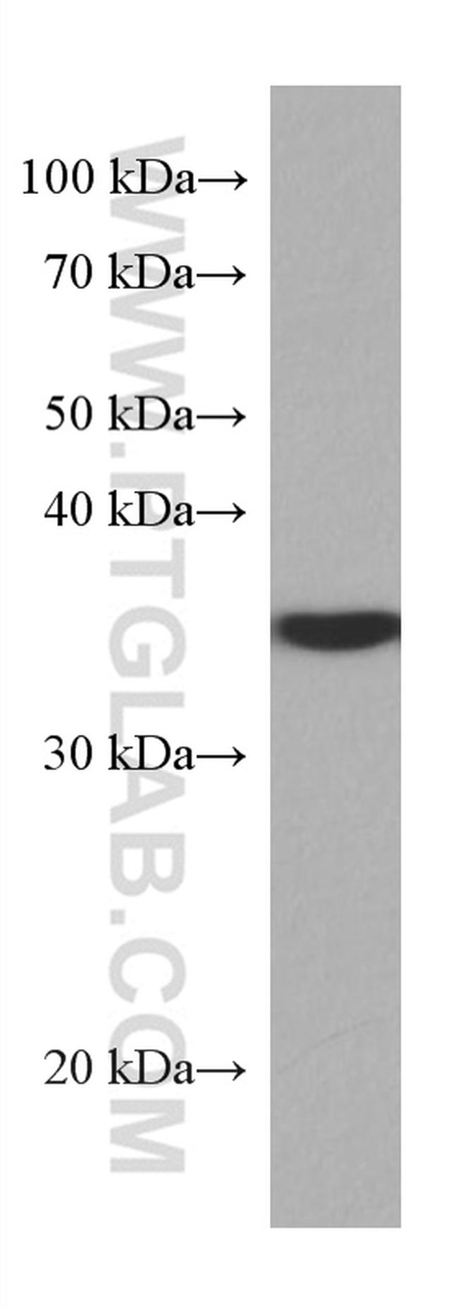 SET Antibody in Western Blot (WB)