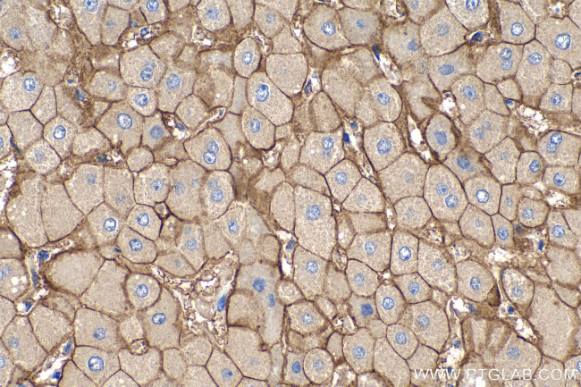 SLC22A7 Antibody in Immunohistochemistry (Paraffin) (IHC (P))