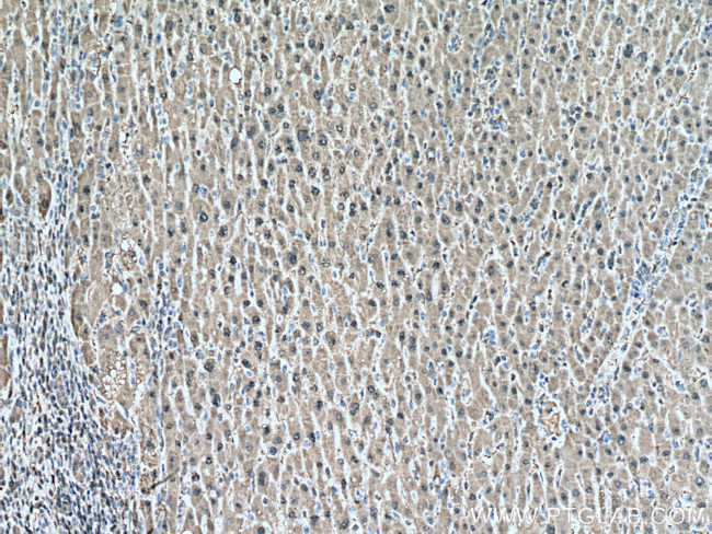 SOD1 Antibody in Immunohistochemistry (Paraffin) (IHC (P))