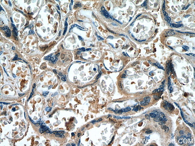 FURIN Antibody in Immunohistochemistry (Paraffin) (IHC (P))