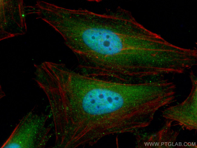 UBC12 Antibody in Immunocytochemistry (ICC/IF)