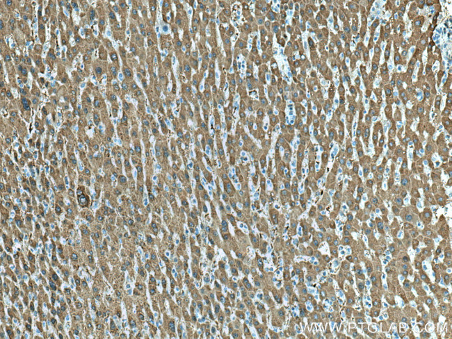 UBC12 Antibody in Immunohistochemistry (Paraffin) (IHC (P))