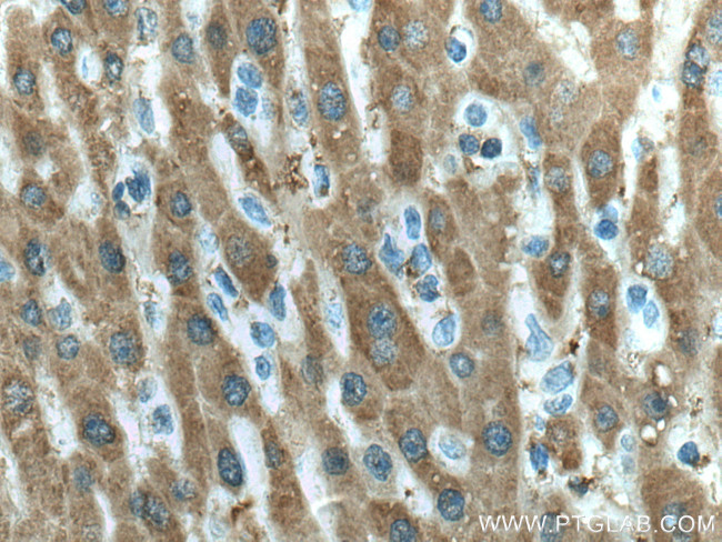 UBC12 Antibody in Immunohistochemistry (Paraffin) (IHC (P))