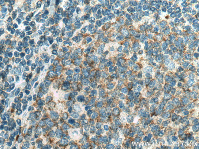 PIP5K1A Antibody in Immunohistochemistry (Paraffin) (IHC (P))