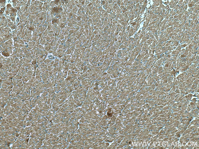 MFN2 Antibody in Immunohistochemistry (Paraffin) (IHC (P))