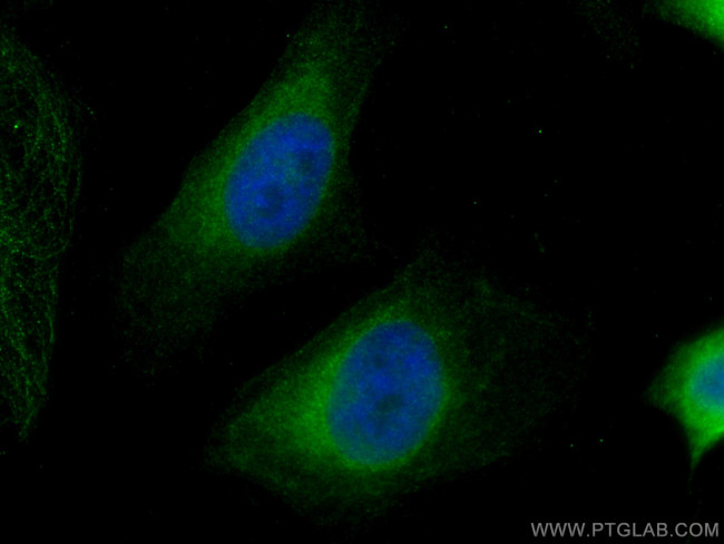 HRD1/SYVN1 Antibody in Immunocytochemistry (ICC/IF)