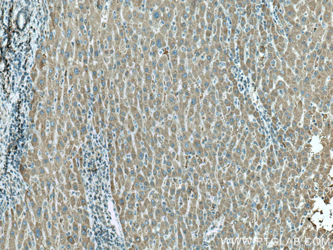 HRD1/SYVN1 Antibody in Immunohistochemistry (Paraffin) (IHC (P))