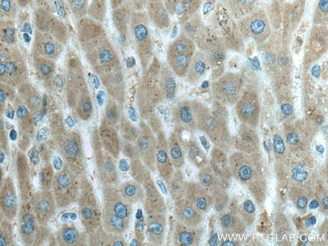 HRD1/SYVN1 Antibody in Immunohistochemistry (Paraffin) (IHC (P))