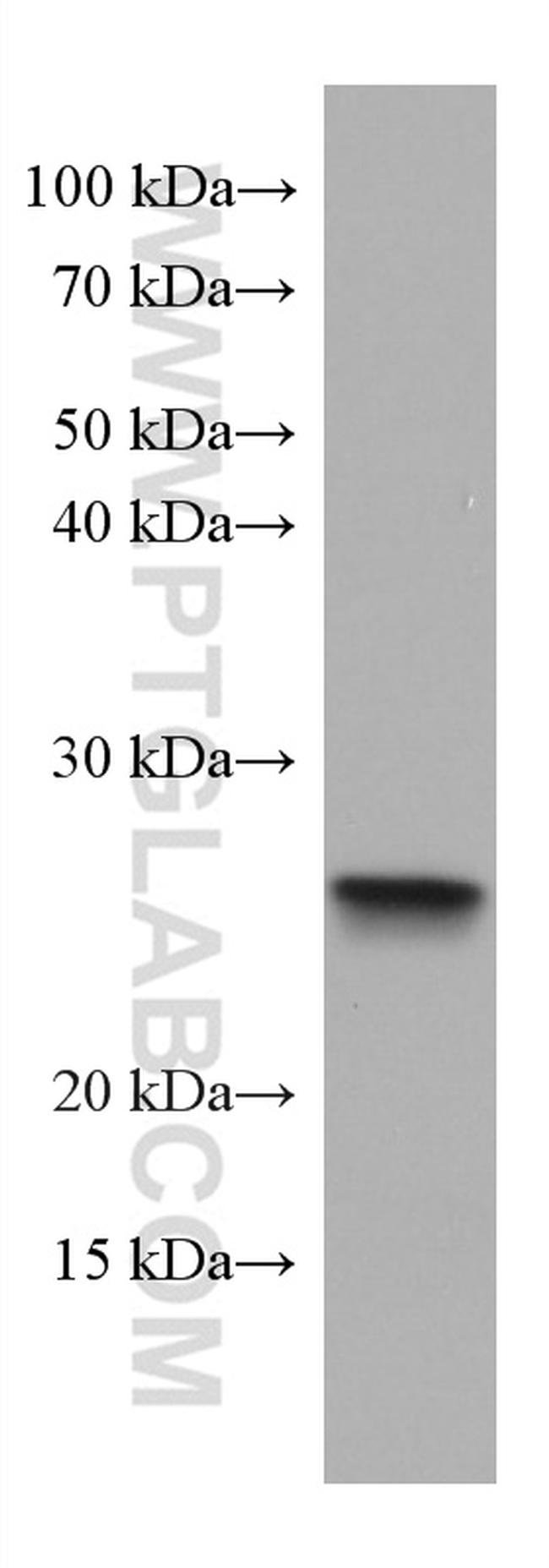 ASC/TMS1 Antibody in Western Blot (WB)
