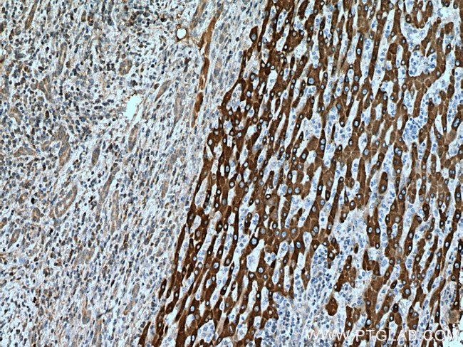 HSD17B6 Antibody in Immunohistochemistry (Paraffin) (IHC (P))