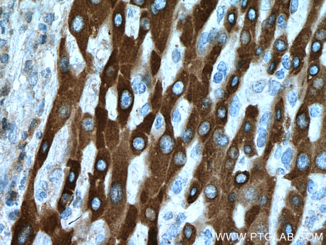 HSD17B6 Antibody in Immunohistochemistry (Paraffin) (IHC (P))