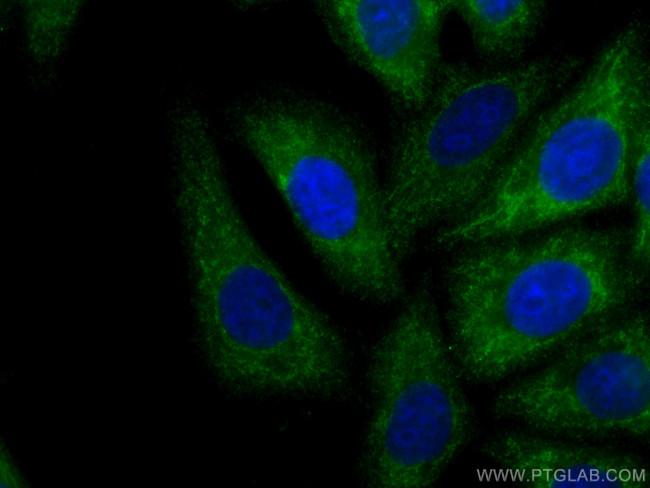 GNB3 Antibody in Immunocytochemistry (ICC/IF)