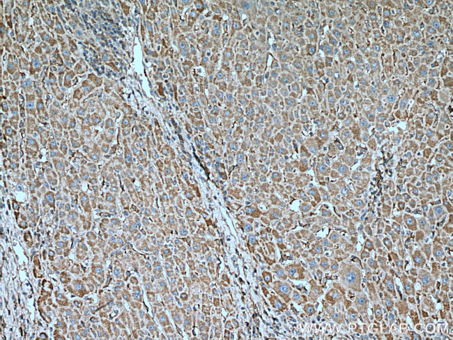 GNB3 Antibody in Immunohistochemistry (Paraffin) (IHC (P))