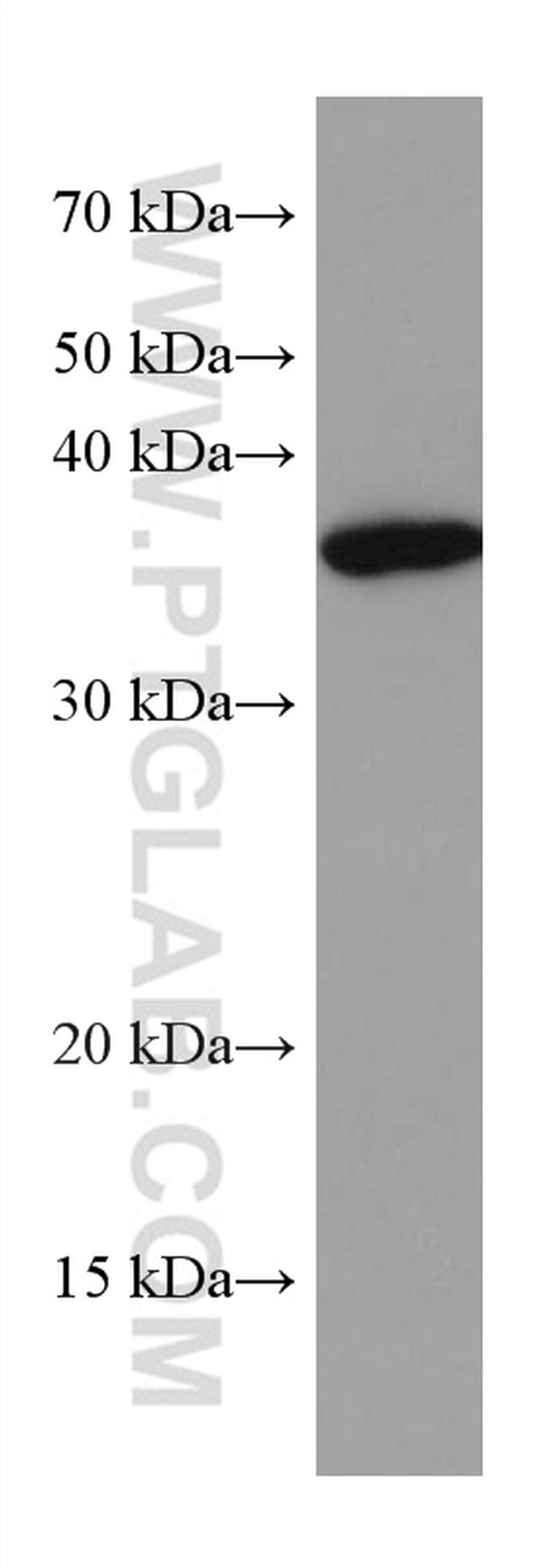 GNB3 Antibody in Western Blot (WB)