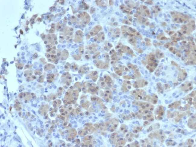 BRCA2 (Breast Marker) Antibody in Immunohistochemistry (Paraffin) (IHC (P))