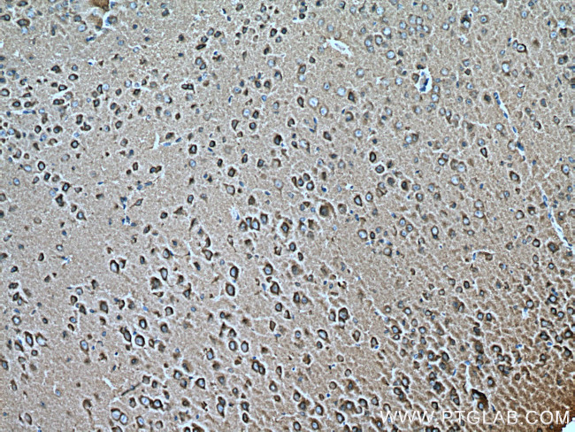 RAB2A Antibody in Immunohistochemistry (Paraffin) (IHC (P))