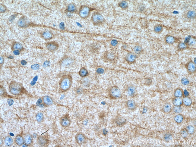 CDK5R1 Antibody in Immunohistochemistry (Paraffin) (IHC (P))