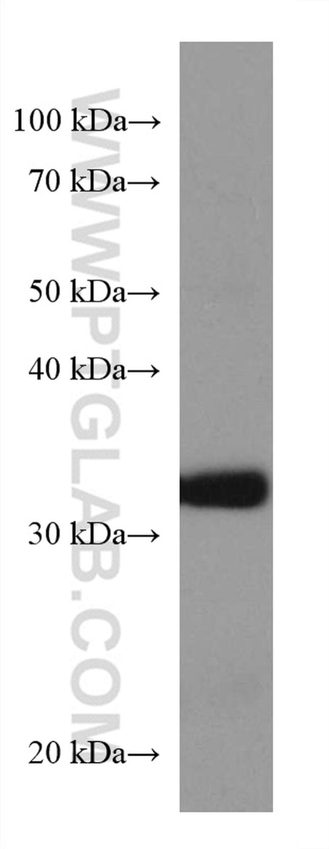 CDK5R1 Antibody in Western Blot (WB)