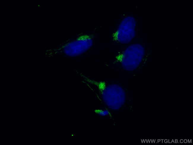 TMF1 Antibody in Immunocytochemistry (ICC/IF)