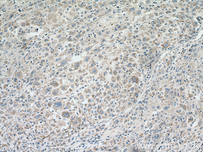 ACO2 Antibody in Immunohistochemistry (Paraffin) (IHC (P))