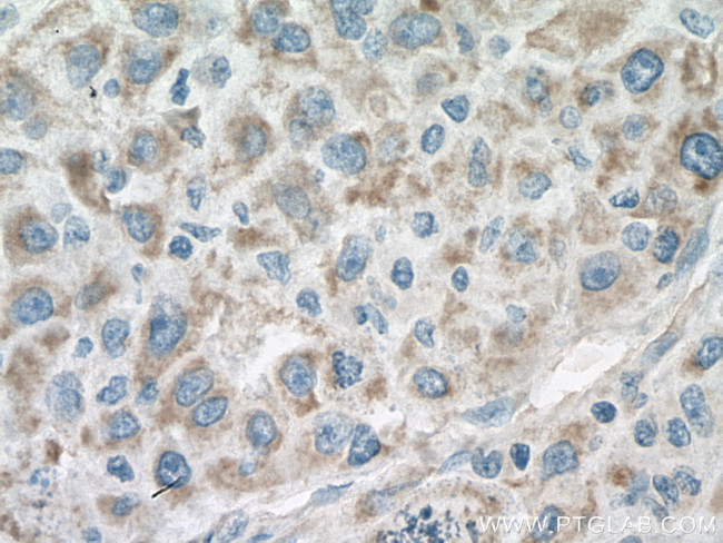 ACO2 Antibody in Immunohistochemistry (Paraffin) (IHC (P))