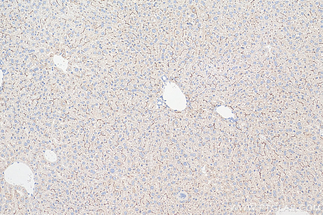 BSEP Antibody in Immunohistochemistry (Paraffin) (IHC (P))