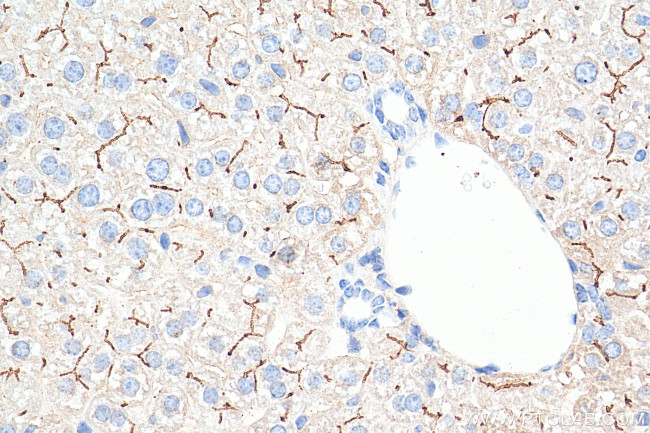 BSEP Antibody in Immunohistochemistry (Paraffin) (IHC (P))