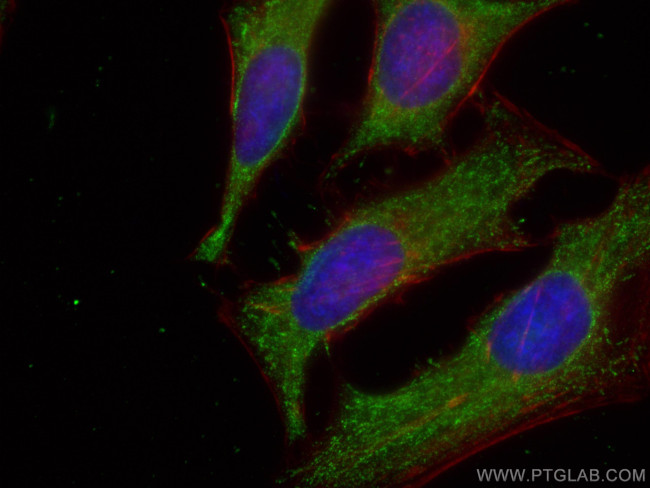 TPI1 Antibody in Immunocytochemistry (ICC/IF)