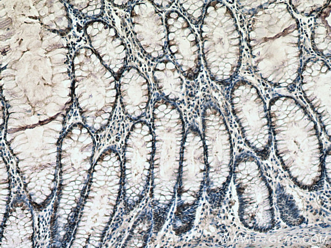 TPI1 Antibody in Immunohistochemistry (Paraffin) (IHC (P))