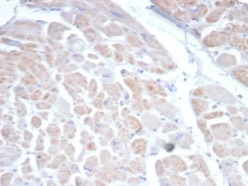 SSTR2 Antibody in Immunohistochemistry (Paraffin) (IHC (P))