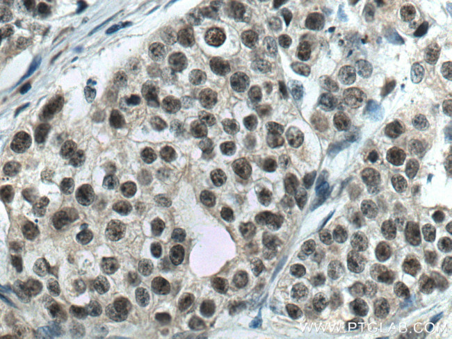 PDS5A Antibody in Immunohistochemistry (Paraffin) (IHC (P))