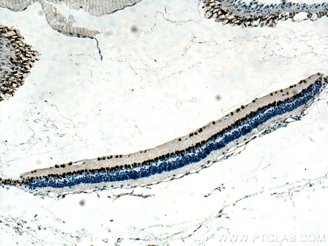 PAX6 Antibody in Immunohistochemistry (Paraffin) (IHC (P))